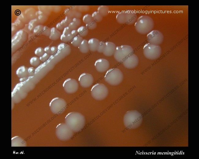 neisseria meningitidis colonies on sheep blood agar